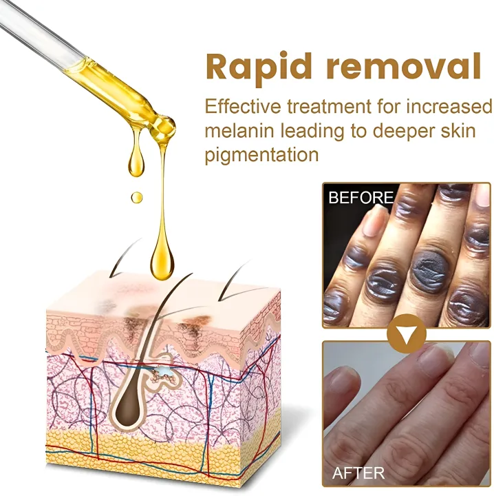 JAYSUING%20Therapy%20Drops-Reduce%20Dark%20Spot%20&%20Lightens%20Skin%20Discoloration%2010ML%20-%20Image%203