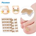 Pexmen 10/20/50/100Pcs Ingrown Toenail Correction Stickers Toenail Corrector Patch Keep Nails Healthy Relieve Pain.