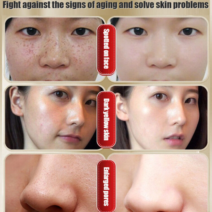 yidaoguang%20Retinol%20Snake%20Venom%20Gold%20Mask%20-%20Image%205