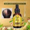 Fast Hair Growth Oil Ginger Growth Hair Treatment Anti Hair Loss Men Women Scalp Treatment Serum Products Beauty Health Product. 