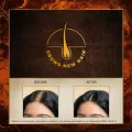 Indulekha Bringha Hair Growth Oil for Men And Women 50 Ml Natural Hair Oil for Hair Growth And Dandruff Control.