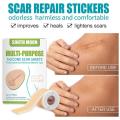 1Roll Scar Treatment Silicone Gel Sheet Efficient Surgery Scar Removal Therapy Patch For Acne Trauma Burn Scar Skin Repair.