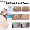 Aichun Beauty Anti-Stretch Marks Cream | Stretch Marks Removal Cream 60g.