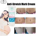 Aichun Beauty Anti-Stretch Marks Cream | Stretch Marks Removal Cream 60g. 