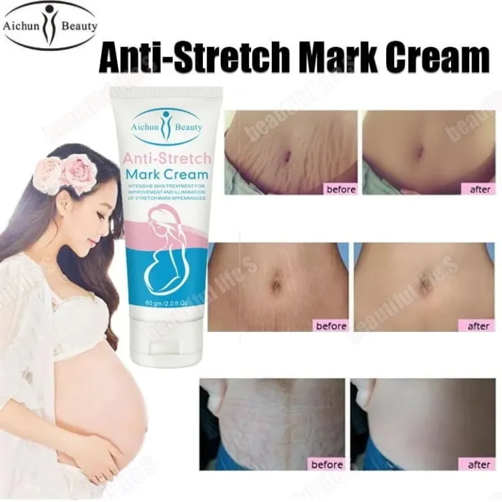 Aichun%20Beauty%20Anti-Stretch%20Marks%20Cream%20%7C%20Stretch%20Marks%20Removal%20Cream%2060g%20-%20Image%206