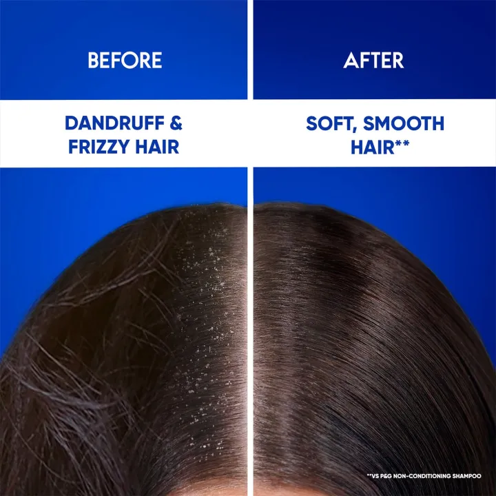 head%20&%20shoulders%20ANTI-DANDRUFF%20SHAMPOO%20SMOOTH%20&%20SILKY%20SMOOTH%20HAIR%20FROM%20ROOT%20TO%20TIP%20400ml%20UAE%20-%20Image%204