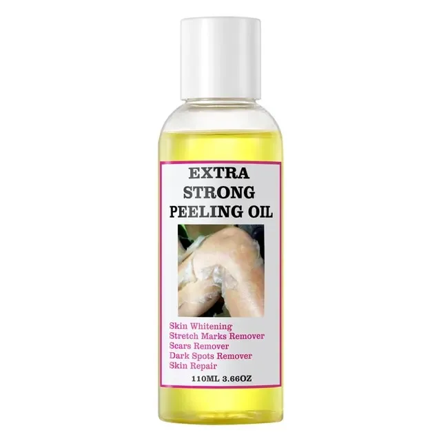 Exfoliator%20Cosmetics%20Yellow%20Peeling%20Oil%20For%20Dead%20Skin%20Removal%20Exfoliating%20facial%20Strength%20Peeling%20Oil%20Skin%20Remove%20Acne%20110ML%20-%20Image%207