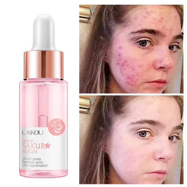 LAIKOU%20%20Japan%20Sakura%20Serum%20Nourish%20Essense%20Oil%20Control%20Brightening%20Rejuvenation%20Skin%20Whitening%20Serum%20Skin%20Care%20Face%20care-17ml%20-%20Image%202