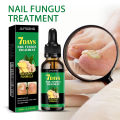 Jaysuing Ginger Nail Care Nail Treatment, Nail fungus care, hand and foot nail care, soft nail brightening nail moisturizer. 