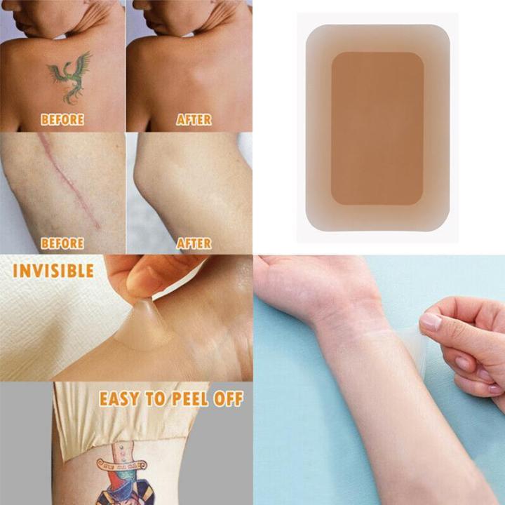 Tattoo%20Cover%20Up%20Sticker%20For%20Scar%20Birthmark%20Cover%20Up%20-%20Image%203