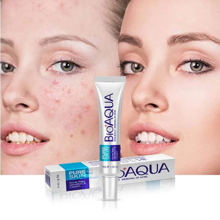 Bioaqua%20Pure%20Skin%20Acne%20Removal%20&%20Rejuvenation%20Cream%20-30gm%20-%20Image%202