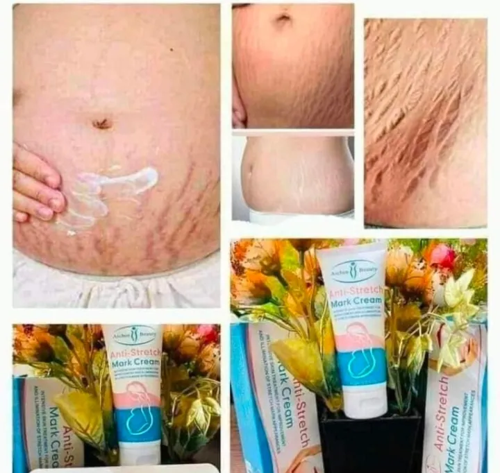 Stretch%20Marks%20Cream%2060%20G%20-%20Image%203