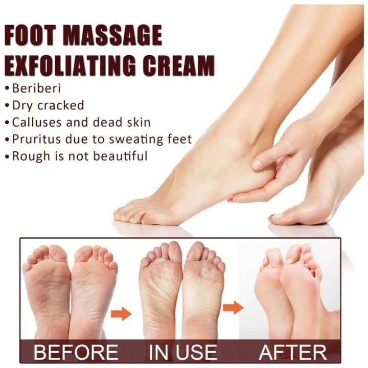 Foot%20Massage%20Exfoliating%20Cream%20Heels%20Anti-Drying%20Peeling%20Cracked%20Feet%20Care%20Moisturizing%20Exfoliation%20remove%20Dead%20Skin%20Foot%20Cream%20-%20Image%203