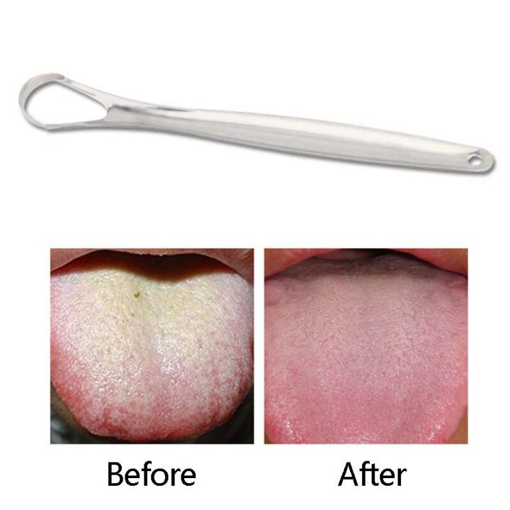 Tongue%20Scraper%20Cleaner%20for%20Adults%20scraper%20304%20stainless%20steel%20-%20Image%203