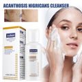 50ml Whitening Facial Cleanser Amino Acid Foam Scrub Cleansing Anti-Acne Oil Control Blackhead Remover Moisturizing Brightening. 