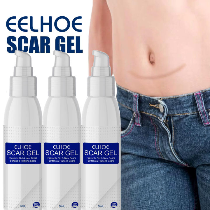 ELHOE%20Scar%20Removal%20Cream%20Gel%20Burn%20Surgical%20Scar%20Cesarean%20Scar%20Repairing%20Stretch%20Marks%20Pigmentation%20Corrector%20-%20Image%202