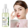 Fenyi Green Tea Facial Serum Sodium Hyaluronic Acid Shrink Pore Moisturizing Oil Control Soothing Acne Skin 17ml. 