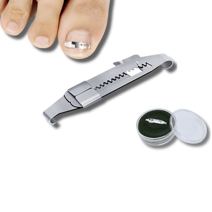 Ingrown%20toenail%20corrector%20Tools%20Pedicure%20Recover%20Embed%20Toe%20Nail%20Treatment%20professional%20Ingrown%20toenail%20correction%20Foot%20Care%20Tool%20-%20Image%204