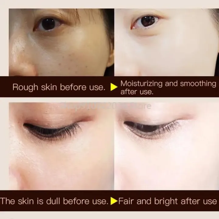 30g%20Woman%20Lady%20Face%20Whitening%20Cream%20For%20Dark%20Skin%20Spots%20Scars%20Snow%20White%20Cream%20Day%20Night%20Face%20Cream%20For%20Skin%20Whitening%20-%20Image%203