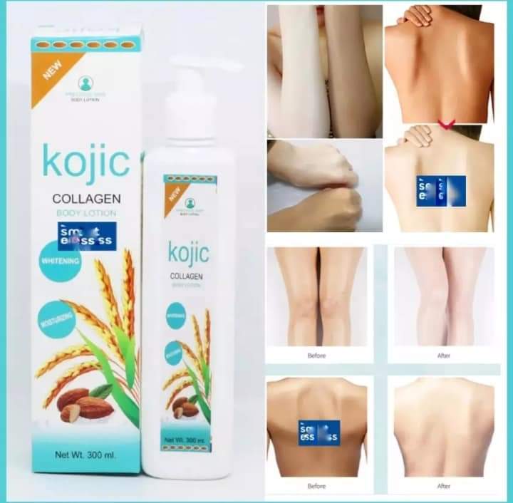 KOJIC%20Collagen%20Body%20Lotion%20-%20Image%202