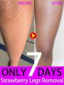 Keratosis Pilaris Removal Cream for Strawberry Legs Hydrating, moisturizing, deep cleansing rough body skin exfoliating scrub.