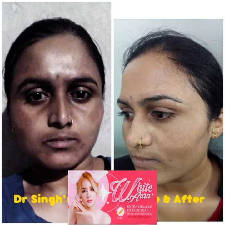 Deep%20Cleansing%20White%20Aura%20Miracle%20Carrot%20Soap%20Fade%20Body%20Shower%20Areola%20Bath%20Quality%20Skin%20For%20Privat%20-100gm%20Premium-Beauty%20soap%20-%20Image%205