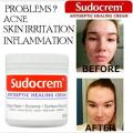 Sudocrem Antiseptic Healing Cream 125g. 