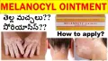 Melanocyl Ointment. 