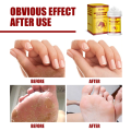 EELHOE 50g Horse Oil Foot Cream Hand Foot Moisturizing Cream Frostbite Moisturizing Antifreeze Anti-cracking. 