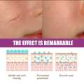 Scar Removal Cream Repairing Damaged Skin Reducing Scars And Smoothing The Skin 50g, কাটা ও পুড়ে যাওয়ার দাগ স্কিন থেকে মুছে ফেলুন। মুখমন্ডল, হাত, পা, বডি অথবা স্কিনের যেকোনো যায়গাতে ব্যবহার করতে পারবেন, #lazbinstore. 