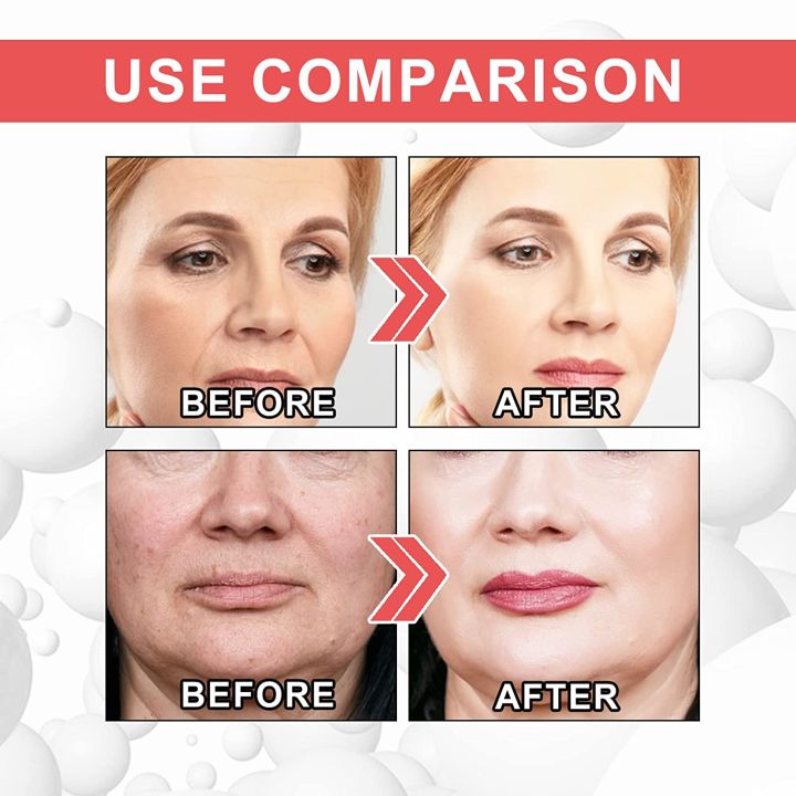 EELHOE%20Women%20Collagen%20Boost%20Anti-Aging%20Serum%20Collagen%20Booster%20for%20Face%20with%20Hyaluronic%20Acid%20Unisex%20Collagen%20Facial%20Cream%20-%20Image%205