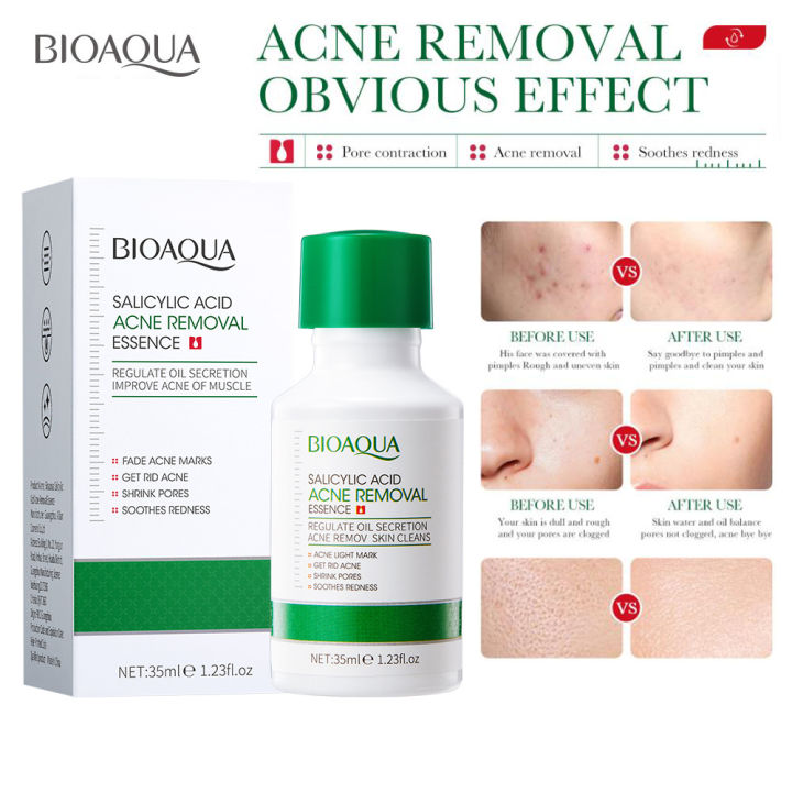 BIOAQUA%20Salicylic%20Acid%20Shrink%20Pores%20Face%20Serum%20Oil%20Control%20Remove%20Acne%20Blackheads%20Dark%20Spot%20Whitening%20Moisturizing%20Skin%20Care%20Essence%20-35ML%20-%20Image%202