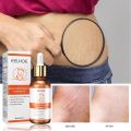 【7Rings Store】Repair Essential Oil Stretch Mark Removal Removal Acne Stretch Marks Fat Striae Gravidarum Oils 20ml.