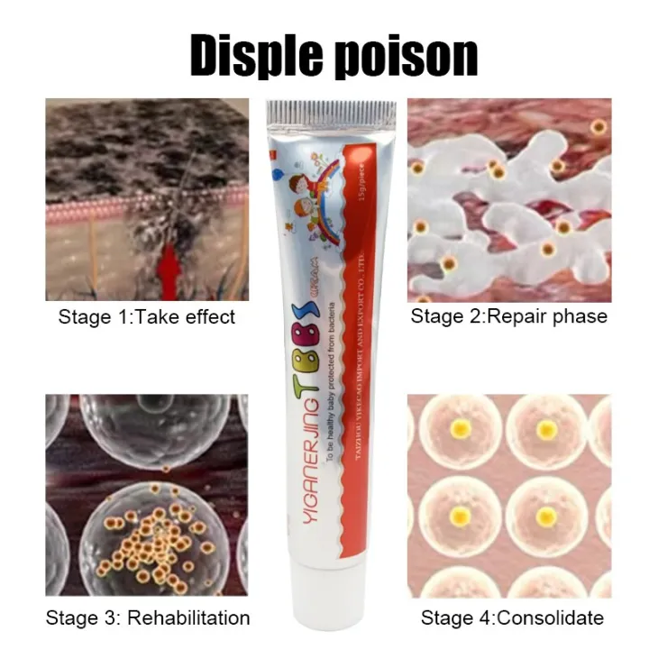 15g%20Chinese%20Medicine%20Psoriasis%20Ointment%20Treat%20Fungal%20Dermatitis%20Antipruritic%20Dressing%20Skim%20Eczema%20Antibacterial%20Repair%20Ointment%20-%20Image%206