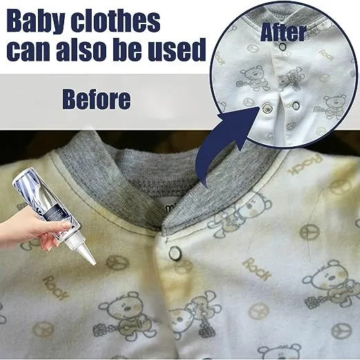 100ml%20Laundry%20Stain%20Remover%20-%20White%20Shirt%20Guardian,%20Laundry%20Stain%20Remover,%20Garment%20Stubborn%20Stain%20Cleaner%20Oil%20Remover%20-%20Image%205
