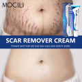 Acne Surgical Stretch Marks Removal Scar Cream Repair Smoothening Whitening Body Skin Care Pigmentation Beauty Cosmetics 20g AOutlierA. 