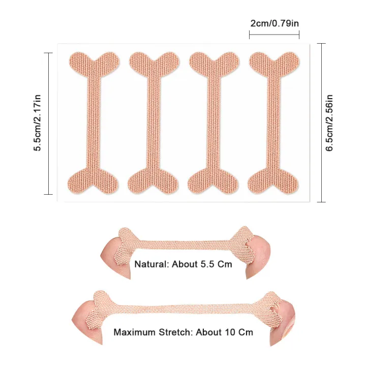 8%20Pack%20Ingrown%20Toenail%20Corrector%20Sticker%20Paronychia%20Treatment%20Fixer%20Restoration%20Pedicure%20Elastic%20Sticker%20Foot%20Toe%20Nail%20Care%20Tool%20-%20Image%204