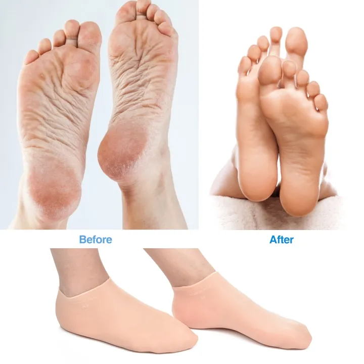 1%20Pair%20Feet%20HaCare%20Socks%20Gloves%20Moisturizing%20Silicone%20Socks%20Foot%20Skin%20Care%20Hand%20Protectors%20Anti%20Cracking%20Spa%20Home%20Use%20-%20Image%204