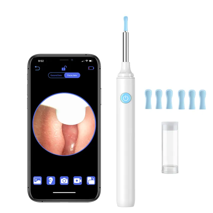 Smart%20Ear%20Wax%20Cleaner%20with%20Camera%203.5mm%20Earpick%20Otoscope%20Visual%20Ear%20Camera%20Health%20Care%20Ear%20Cleaner%20for%20iPhone,%20iPad,%20Android%20-%20Image%207