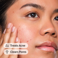 Salicylic Acid 2% Solution - 30ml (Double Layer Sticker) | Acne & Blemish Control Serum. 