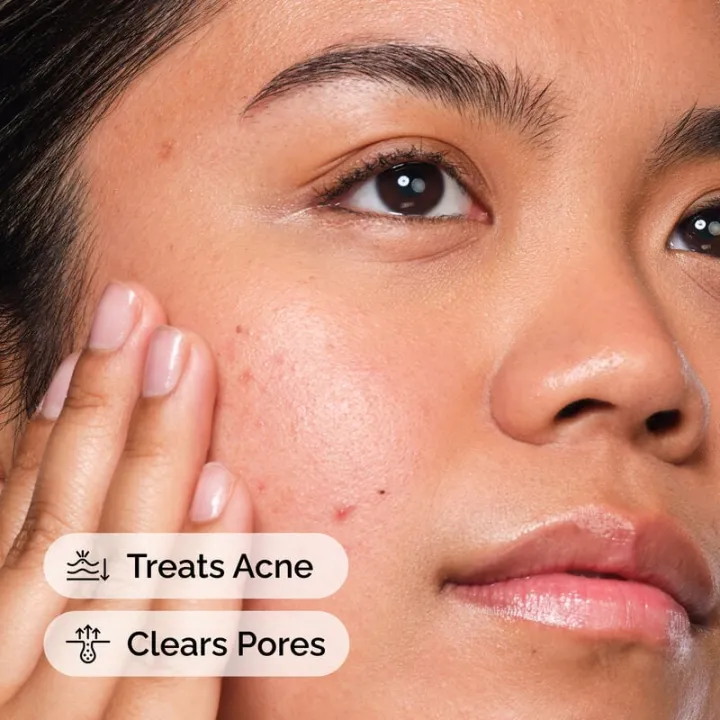 Salicylic%20Acid%202%25%20Solution%20-%2030ml%20(Double%20Layer%20Sticker)%20%7C%20Acne%20&%20Blemish%20Control%20Serum%20-%20Image%202
