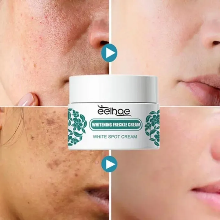 Desalinate%20Melasma%20Cream%20Reduces%20Melanin%20and%20Improves%20Dry%20Dull%20for%20Women%20Replenishing%20Facial%20Moisture%20Skin%20Lifting%20Care%20Cream%20-%20Image%203