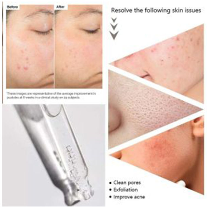 Salicylic%20Acid%202%25%20Solution%20serum%20(granted%20product%20)%20-%20Image%204