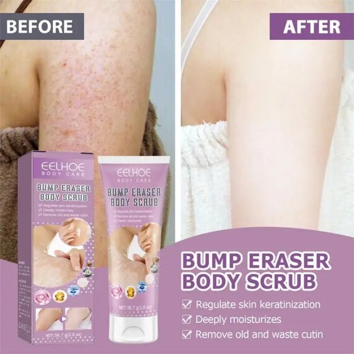 7-Day%20Fast%20Body%20Scrub%20Cream%20Moisturizing%20Skin%20Repair%20Keratosis%20Pilaris%20Removing%20Strawberry%20Legs%20Eraser%20Nourishing%20Body%20Skin%20Care%20-%20Image%202