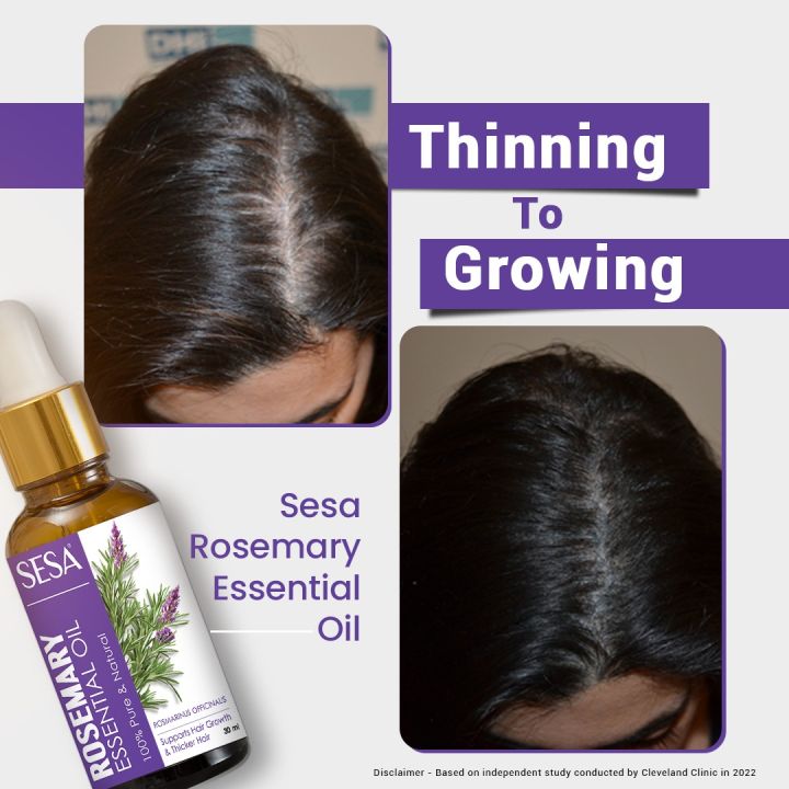 Sesa%20Rosemary%20Essential%20Oil%2015ml%20-%20Image%205