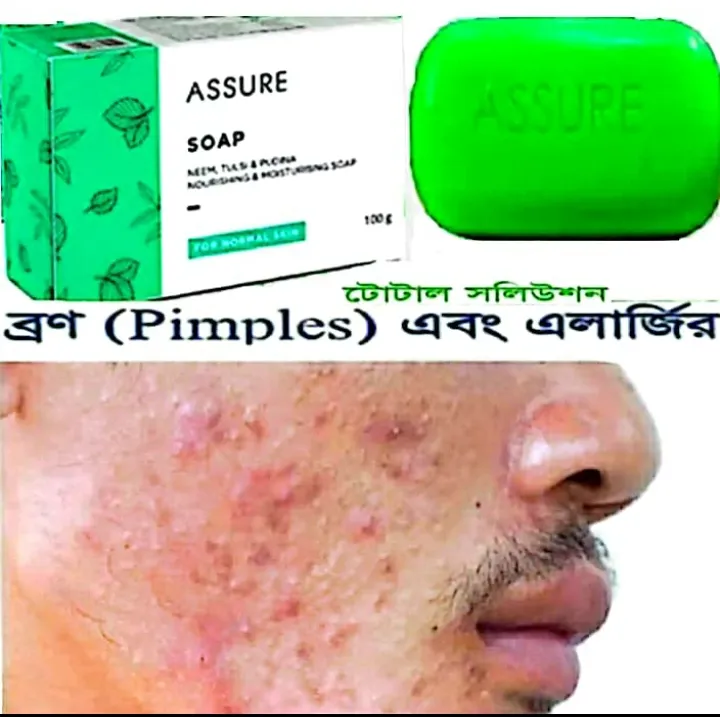 Assure%20Nim%20Tulsi%20Pudina%20Soap%20100g%20BD%201%20-%20Image%205