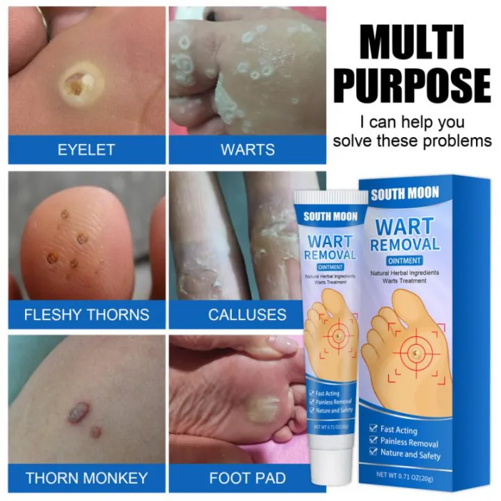 %E3%80%90Best%20value%20for%20money%E3%80%91%20New%201%20Foot%20Care%20Medical%20Corn%20Removal%20Pad%20Wart%20Thorn%20Curative%20Cream%20Callue%20Calloity%20Wart%20Ointment%20Treatment%20Againt%20Mole%20kin%20-%20Image%203