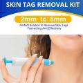 2 In1 Painless Auto Skin Tag Mole Wart Removal Kit Cleaning Tools Face Skin Care Body Wart Dot Treatments Remover Beauty Health Vnce Lncei.