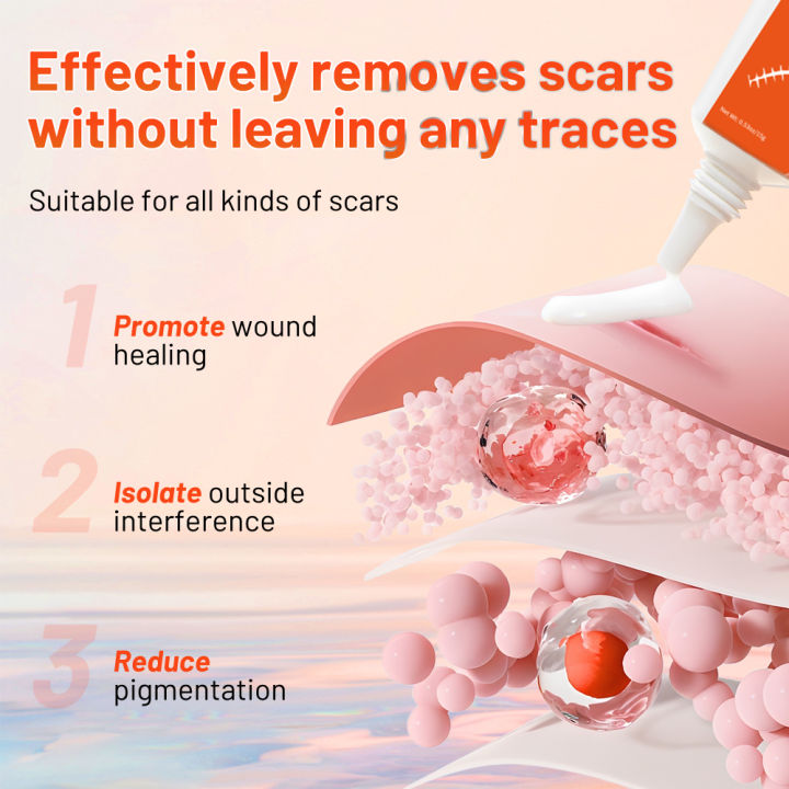 MeiYanQiong%20Acne%20Scar%20Remove%20Scar%20Cream%20Skin%20Repair%20Stretch%20Marks%20Keloid%20Remover%20Desalination%20Scar%20Face%20Cream%20Spots%20Effective%20Treatment%2015g%20-%20Image%205