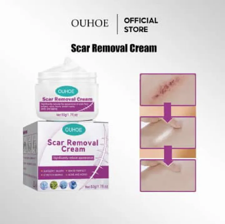 Scar%20Removal%20Cream%20Repairing%20Damaged%20Skin%20Reducing%20Scars%20And%20Smoothing%20The%20Skin%2050g,%20%E0%A6%95%E0%A6%BE%E0%A6%9F%E0%A6%BE%20%E0%A6%93%20%E0%A6%AA%E0%A7%81%E0%A7%9C%E0%A7%87%20%E0%A6%AF%E0%A6%BE%E0%A6%93%E0%A7%9F%E0%A6%BE%E0%A6%B0%20%E0%A6%A6%E0%A6%BE%E0%A6%97%20%E0%A6%B8%E0%A7%8D%E0%A6%95%E0%A6%BF%E0%A6%A8%20%E0%A6%A5%E0%A7%87%E0%A6%95%E0%A7%87%20%E0%A6%AE%E0%A7%81%E0%A6%9B%E0%A7%87%20%E0%A6%AB%E0%A7%87%E0%A6%B2%E0%A7%81%E0%A6%A8%E0%A5%A4%20%E0%A6%AE%E0%A7%81%E0%A6%96%E0%A6%AE%E0%A6%A8%E0%A7%8D%E0%A6%A1%E0%A6%B2,%20%E0%A6%B9%E0%A6%BE%E0%A6%A4,%20%E0%A6%AA%E0%A6%BE,%20%E0%A6%AC%E0%A6%A1%E0%A6%BF%20%E0%A6%85%E0%A6%A5%E0%A6%AC%E0%A6%BE%20%E0%A6%B8%E0%A7%8D%E0%A6%95%E0%A6%BF%E0%A6%A8%E0%A7%87%E0%A6%B0%20%E0%A6%AF%E0%A7%87%E0%A6%95%E0%A7%8B%E0%A6%A8%E0%A7%8B%20%E0%A6%AF%E0%A6%BE%E0%A7%9F%E0%A6%97%E0%A6%BE%E0%A6%A4%E0%A7%87%20%E0%A6%AC%E0%A7%8D%E0%A6%AF%E0%A6%AC%E0%A6%B9%E0%A6%BE%E0%A6%B0%20%E0%A6%95%E0%A6%B0%E0%A6%A4%E0%A7%87%20%E0%A6%AA%E0%A6%BE%E0%A6%B0%E0%A6%AC%E0%A7%87%E0%A6%A8,%20#lazbinstore%20-%20Image%205